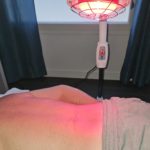 ACUPUNCTURE
