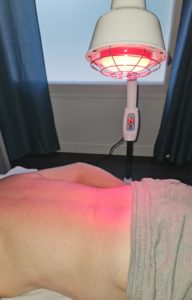 ACUPUNCTURE