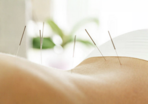 ACUPUNCTURE ISLE SUR LA SORGUE